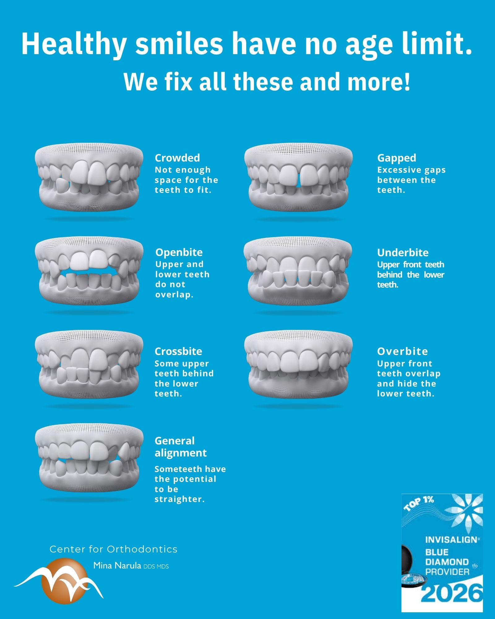 Invisalign clear aligners can help all kinds of smiles