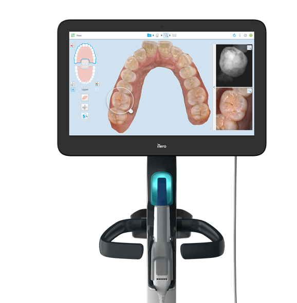 How does Invisalign® treatment work? How does Invisalign® treatment work?